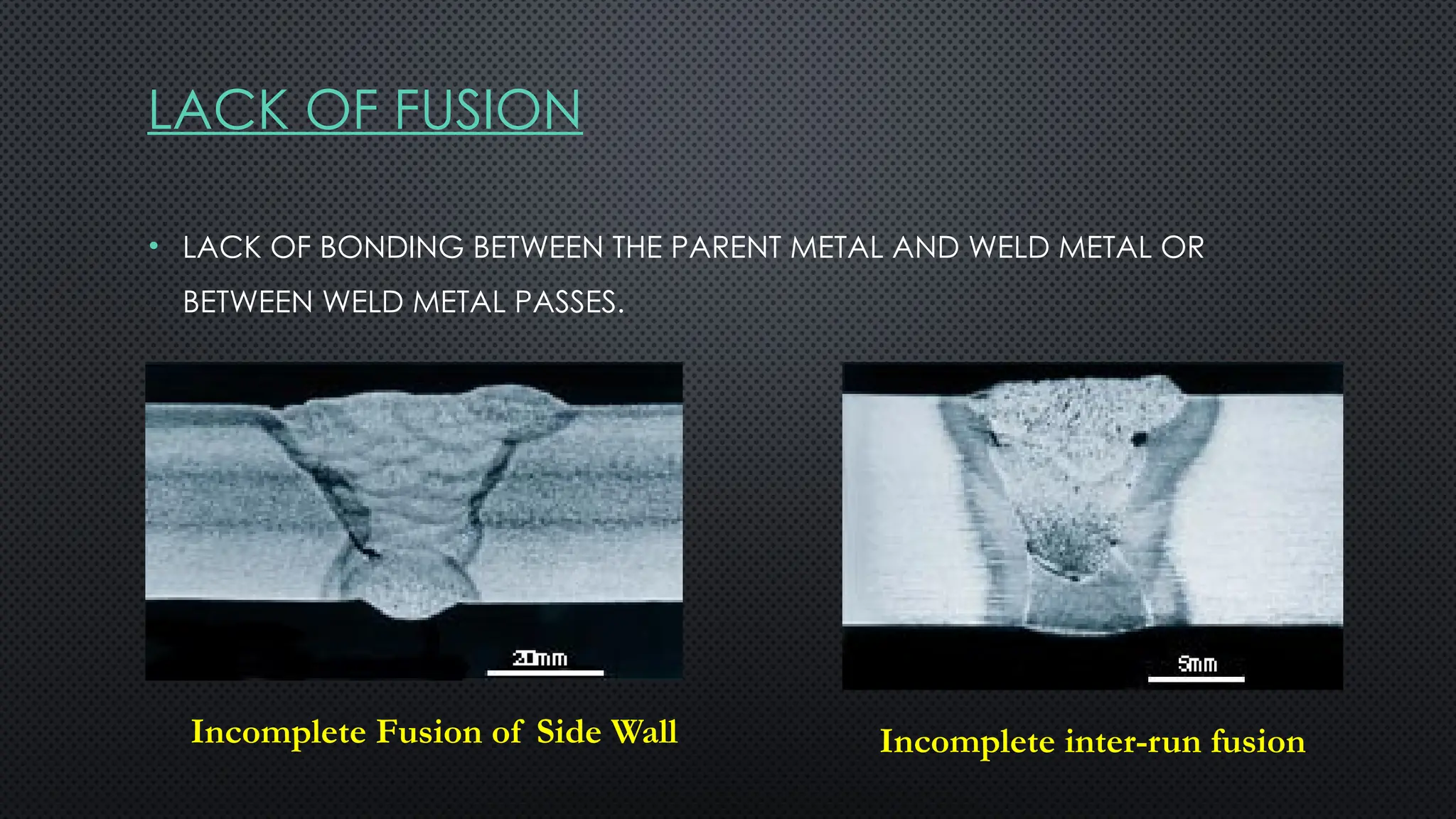 LACK OF FUSION
• LACK OF BONDING BETWEEN THE PARENT METAL AND WELD METAL OR
BETWEEN WELD METAL PASSES.
Incomplete Fusion of Side Wall Incomplete inter-run fusion
 