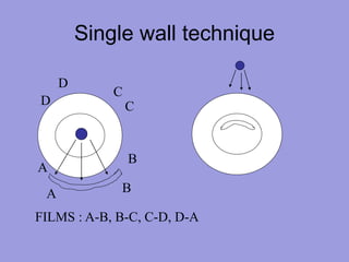 Single wall technique
A B
A
B
C
C
D
D
FILMS : A-B, B-C, C-D, D-A
 