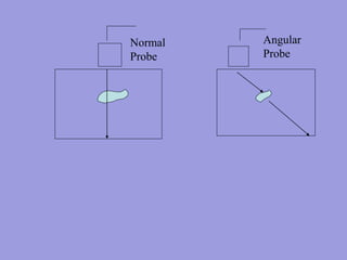 Normal
Probe
Angular
Probe
 