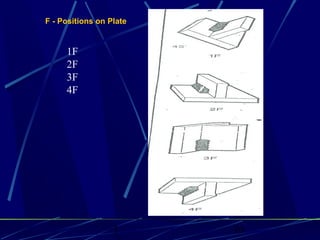 1 10
F - Positions on Plate
1F
2F
3F
4F
 
