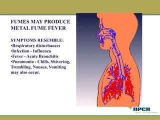 FUMES MAY PRODUCE
METAL FUME FEVER
SYMPTOMS RESEMBLE:
•Respiratory disturbances
•Infection - Influenza
•Fever - Acute Bronchitis
•Pneumonia - Chills, Shivering,
Trembling, Nausea, Vomiting
may also occur.
 