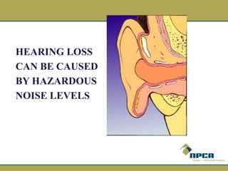 HEARING LOSS
CAN BE CAUSED
BY HAZARDOUS
NOISE LEVELS
 