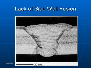 Lack of Side Wall Fusion 