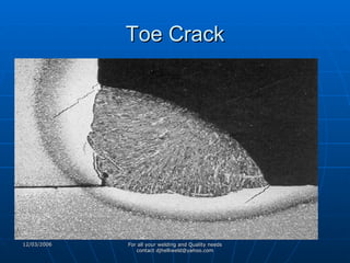 Toe Crack 