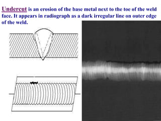 Undercut Radiograph welding FLAWS.ppt