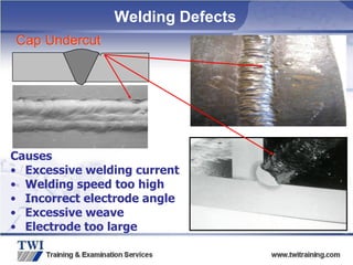 Copyright
©
TWI
Ltd
2009
Cap Undercut
Causes
• Excessive welding current
• Welding speed too high
• Incorrect electrode angle
• Excessive weave
• Electrode too large
Welding Defects
 