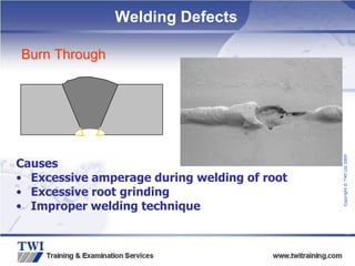Copyright
©
TWI
Ltd
2009
Burn Through
Causes
• Excessive amperage during welding of root
• Excessive root grinding
• Improper welding technique
Welding Defects
 