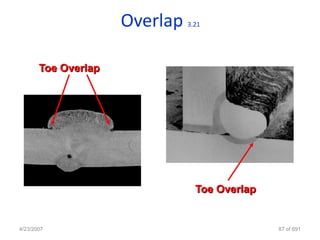 Overlap   3.21




       Toe Overlap




                                 Toe Overlap


4/23/2007                                      87 of 691
 