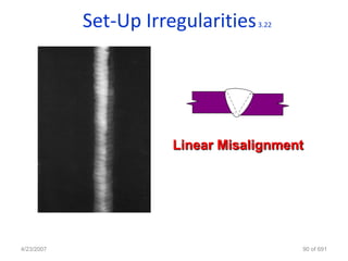 Set-Up Irregularities   3.22




                      Linear Misalignment




4/23/2007                                  90 of 691
 