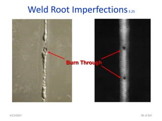 Weld Root Imperfections   3.25




                    Burn Through




4/23/2007                                    96 of 691
 