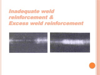 Inadequate weld
reinforcement &
Excess weld reinforcement
 