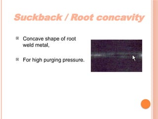 Suckback / Root concavity
 Concave shape of root
weld metal,
 For high purging pressure.
 