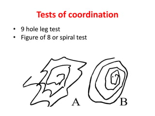 Tests of coordination
• 9 hole leg test
• Figure of 8 or spiral test
 