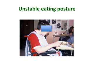 Unstable eating posture
 