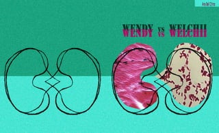 Wendy vs welchii novela grafica Ana Bell Chino