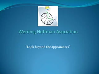Werdnig Hoffman Asociation “Look beyond the appearances” 