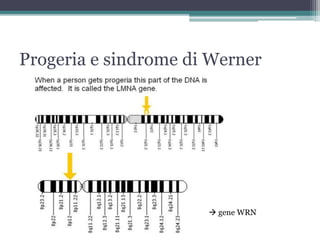 Sindrome di WERNER PPT