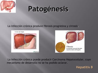 Patogénesis
La infección crónica produce fibrosis progresiva y cirrosis.

La infección crónica puede producir Carcinoma Hepatocelular, cuyo
mecanismo de desarrollo no se ha podido aclarar.

Hepatitis B

 