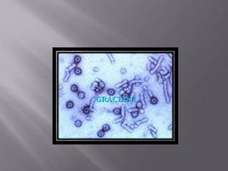 HEPATITS EN PEDIATRIA