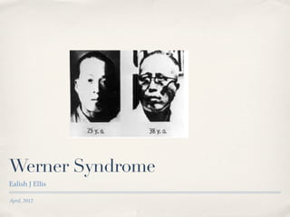 Werner Syndrome
Ealish J Ellis

April, 2012
 