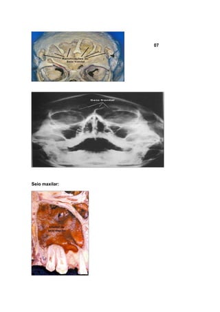 07

Seio maxilar:

 
