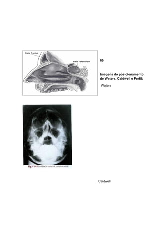 09

Imagens do posicionamento
de Waters, Caldwell e Perfil:
Waters

Caldwell

 