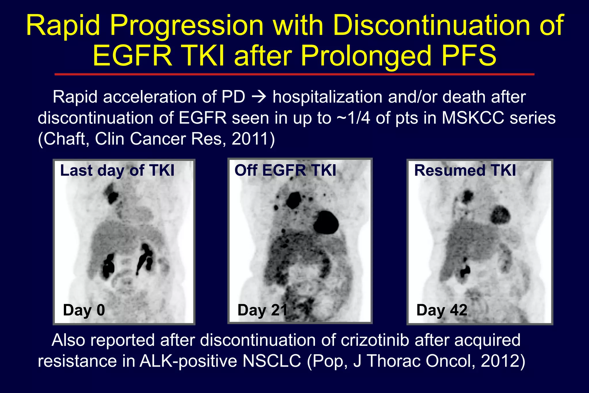 Rapid Progression with Discontinuation of
EGFR TKI after Prolonged PFS
Rapid acceleration of PD  hospitalization and/or death after
discontinuation of EGFR seen in up to ~1/4 of pts in MSKCC series
(Chaft, Clin Cancer Res, 2011)
Last day of TKI

Off EGFR TKI

Resumed TKI

Day 0

Day 21

Day 42

Also reported after discontinuation of crizotinib after acquired
resistance in ALK-positive NSCLC (Pop, J Thorac Oncol, 2012)

 