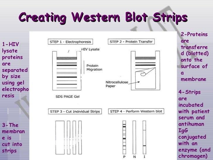 serum electrophoresis