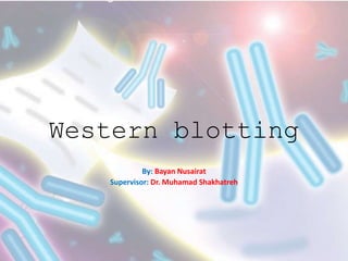 Western blotting
By: Bayan Nusairat
Supervisor: Dr. Muhamad Shakhatreh
 