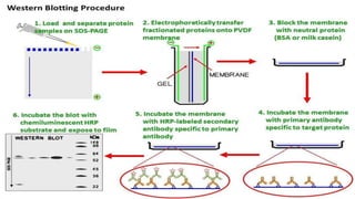 Wb Process Western blotting | PPTX