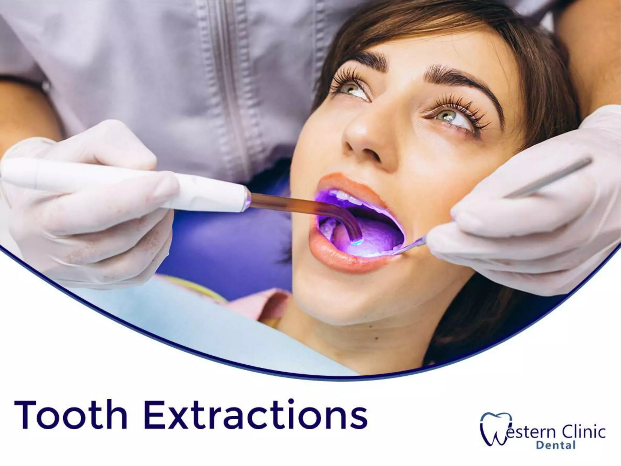 Western Clinic Dental Tooth Extraction PPT