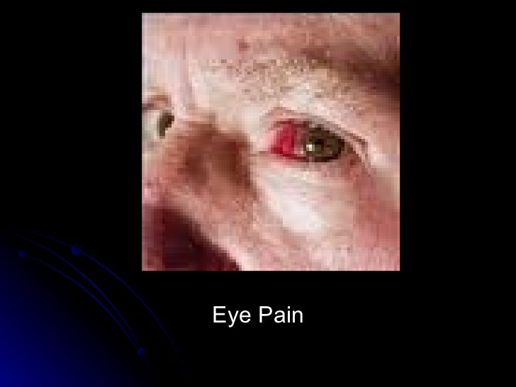 West Nile Virus What Is West Nile Virus Early Symptoms How To Avoid Infection - 00xzrj4