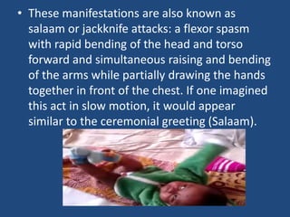 • These manifestations are also known as
  salaam or jackknife attacks: a flexor spasm
  with rapid bending of the head and torso
  forward and simultaneous raising and bending
  of the arms while partially drawing the hands
  together in front of the chest. If one imagined
  this act in slow motion, it would appear
  similar to the ceremonial greeting (Salaam).
 