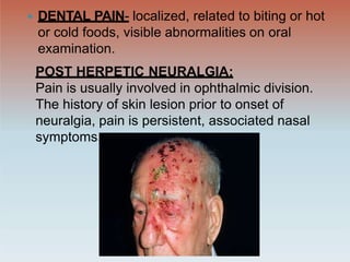  DENTAL PAIN- localized, related to biting or hot
or cold foods, visible abnormalities on oral
examination.
POST HERPETIC NEURALGIA:
Pain is usually involved in ophthalmic division.
The history of skin lesion prior to onset of
neuralgia, pain is persistent, associated nasal
symptoms.
 