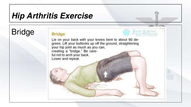 Hip Arthritis Exercise Bridge Hip Arthritis Exercise Bridge