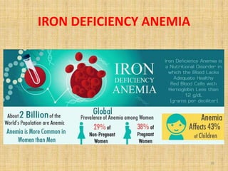 IRON DEFICIENCY ANEMIA
26
 