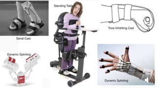 Constraint induced movement
therapy
 Two primary component
 Intensive motor training of more affected limb (up to six ho...