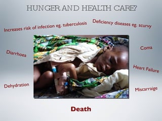 HUNGER AND HEALTH CARE? Increases risk of infection eg. tuberculosis Deficiency diseases eg. scurvy Diarrhoea Dehydration Coma Miscarraige Heart Failure Death 