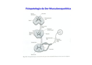 Fisiopatologia da Dor Musculoesquelética
 