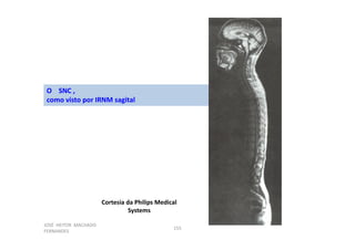 JOSÉ HEITOR MACHADO
FERNANDES
155
O SNC ,
como visto por IRNM sagital
Cortesia da Philips Medical
Systems
 