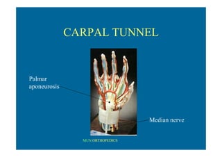 MUN ORTHOPEDICS
CARPAL TUNNEL
Palmar
aponeurosis
Median nerve
 