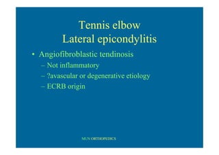MUN ORTHOPEDICS
Tennis elbow
Lateral epicondylitis
• Angiofibroblastic tendinosis
– Not inflammatory
– ?avascular or degenerative etiology
– ECRB origin
 