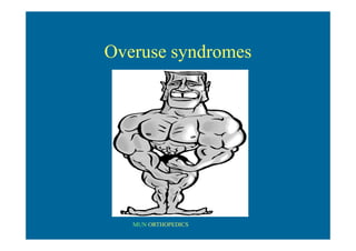 MUN ORTHOPEDICS
Overuse syndromes
 