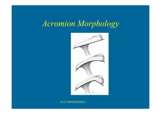 MUN ORTHOPEDICS
Acromion Morphology
 