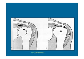 figura
MUN ORTHOPEDICS
 