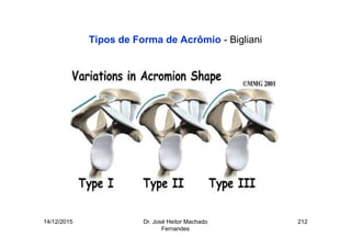 14/12/2015 Dr. José Heitor Machado
Fernandes
212
Tipos de Forma de Acrômio - Bigliani
 