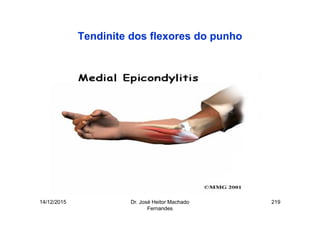14/12/2015 Dr. José Heitor Machado
Fernandes
219
Tendinite dos flexores do punho
 