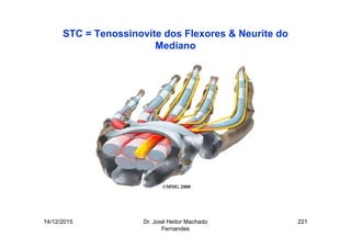 14/12/2015 Dr. José Heitor Machado
Fernandes
221
STC = Tenossinovite dos Flexores & Neurite do
Mediano
 