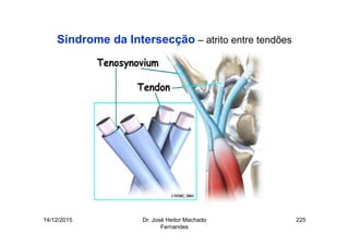 14/12/2015 Dr. José Heitor Machado
Fernandes
225
Síndrome da Intersecção – atrito entre tendões
 