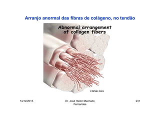 14/12/2015 Dr. José Heitor Machado
Fernandes
231
Arranjo anormal das fibras de colágeno, no tendão
 